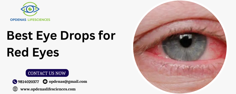 Best Eye Drops for Red Eyes